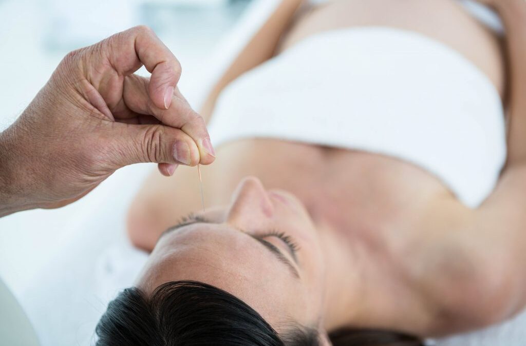 Acupunctuur tijdens de zwangerschap: do’s en don’ts